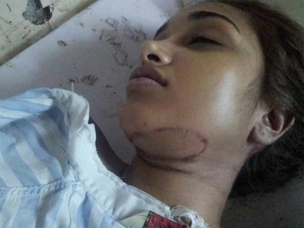 जिया के गले पर गहरे जख्म के निशान