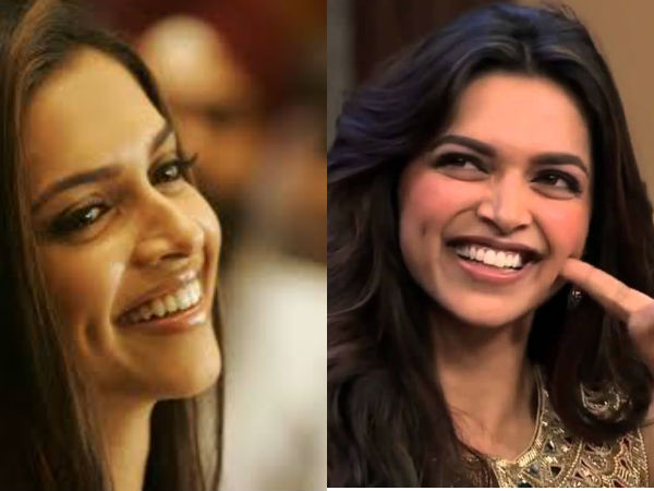 उफ्फ ये गड्ढे....अरे dIMPLES उफ्फ ये गड्ढे....अरे dIMPLES