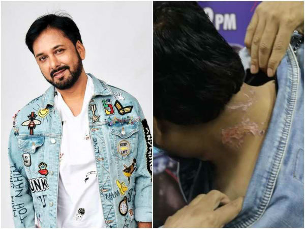 मेरे ऊपर ब्लीच डाला गया